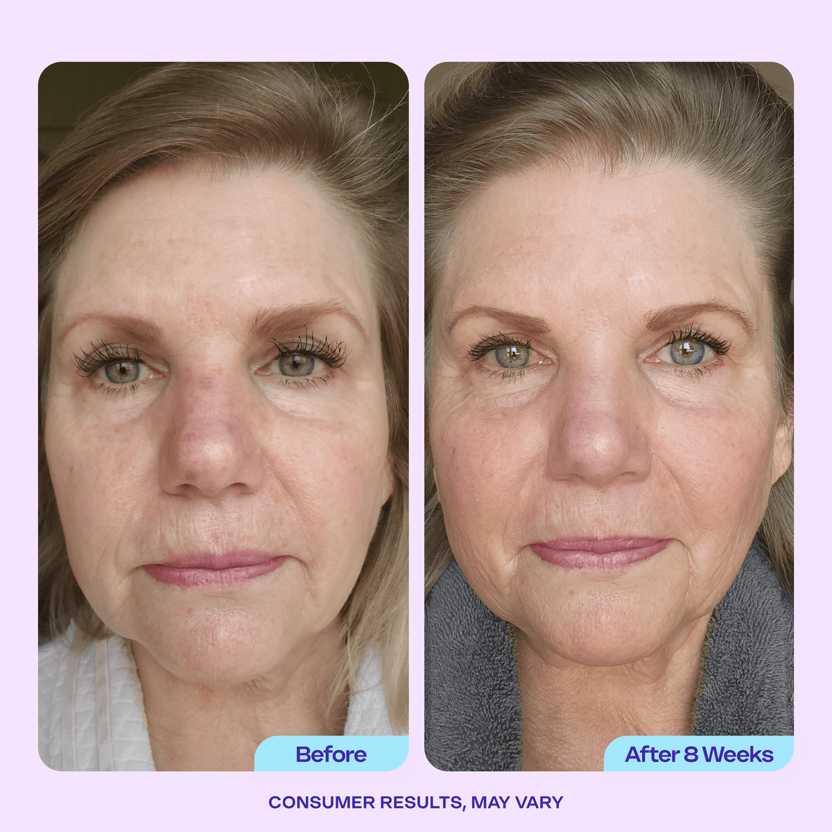 Smooth & Lift Duo