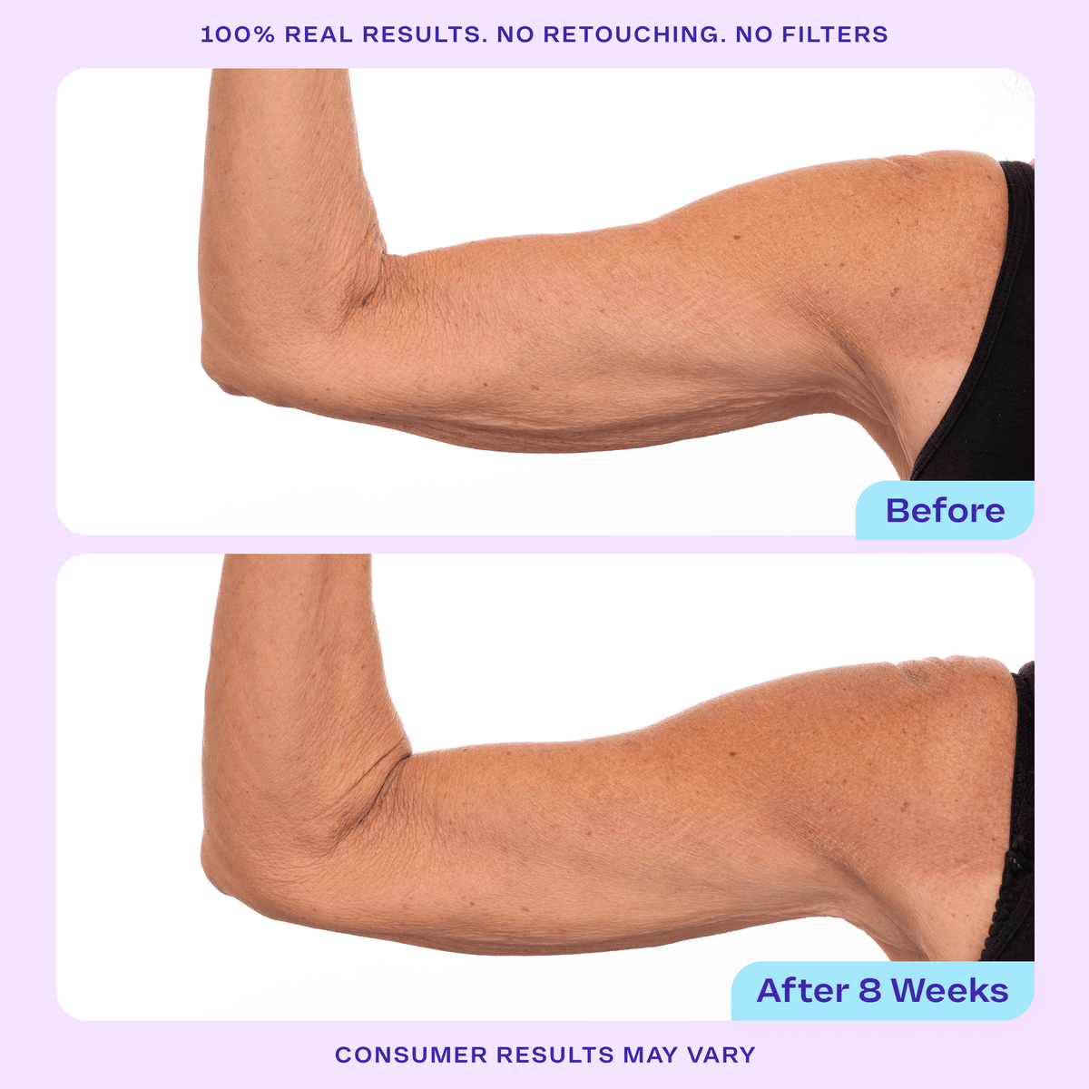 Side-by-side “Before” and “After 8 Weeks” photos showing a bent arm with visible skin texture improvement. Text above reads “100% Real Results. No Retouching. No Filters.”
