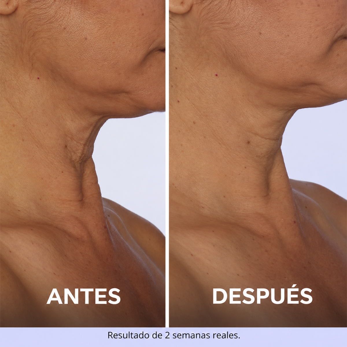 Tighten & Lift Neck Cream